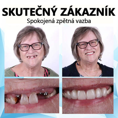 💎𝐁𝐢𝐤𝐞𝐧𝐝𝐚™ Silikonová podložka na zubní protézu (⏰Časově omezená sleva, posledních 30 minut⏰)