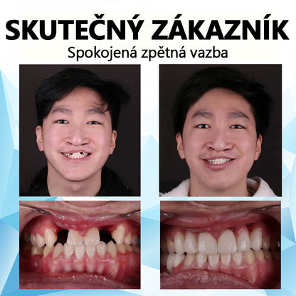 💎𝐁𝐢𝐤𝐞𝐧𝐝𝐚™ Silikonová podložka na zubní protézu (⏰Časově omezená sleva, posledních 30 minut⏰)